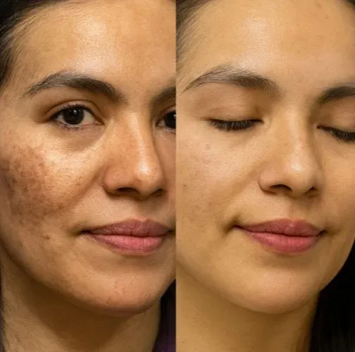 Resultado real de cliente